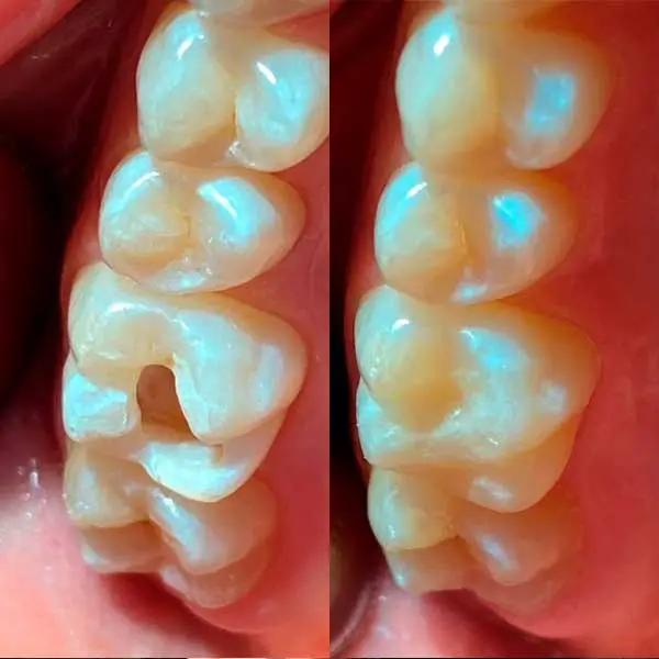 Odontología conservadora en Logroño