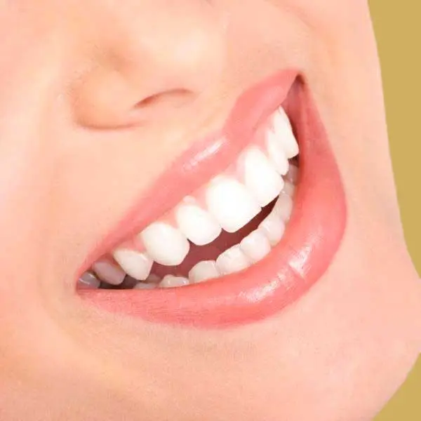 blanqueamiento dental en Logroño